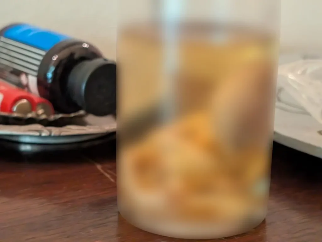 Σύλληψη 77χρονου για αρχαιοκαπηλία-Σε φιάλη διατηρούσε ανθρώπινο έμβρυο