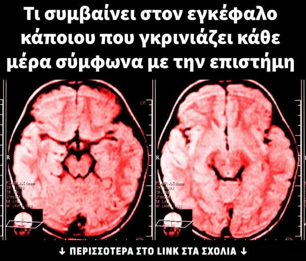 Τί συμβαίνει στον εγκέφαλό μας αν γκρινιάζουμε συνέχεια  