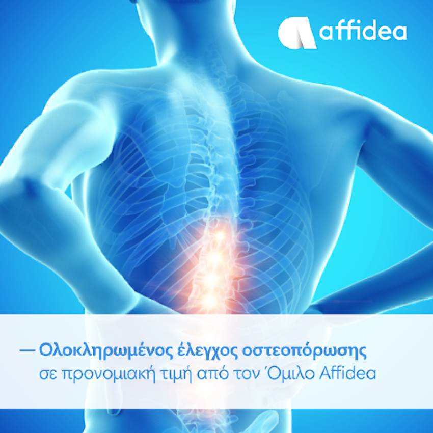 Ολοκληρωμένος έλεγχος οστεοπόρωσης σε προνομιακή τιμή από τον Όμιλο Affidea