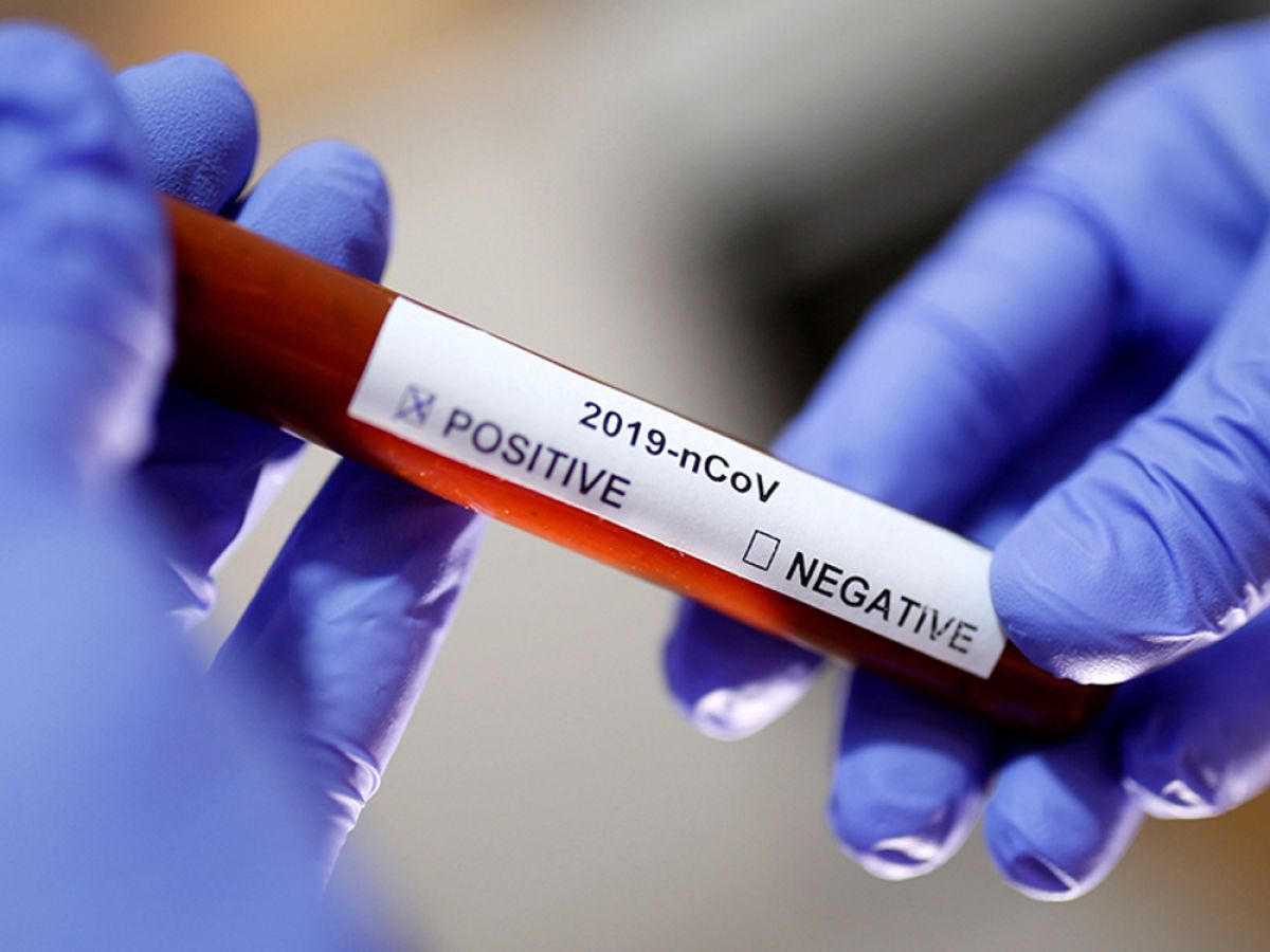 43 Κρούσματα covid 19 στην Περιφέρεια Πελοποννήσου