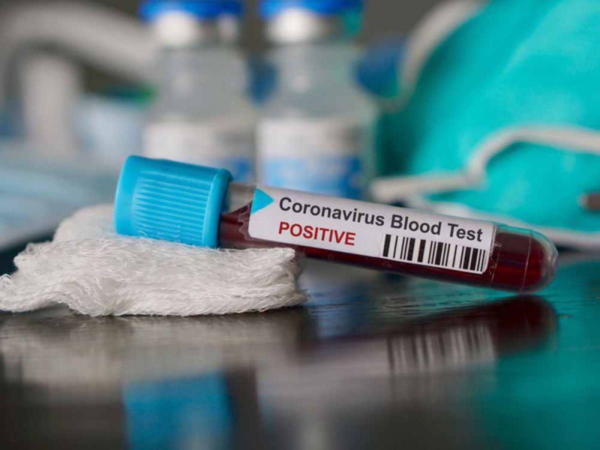 73 νέα κρούσματα κορωνοϊού στην Πελοπόννησο, σήμερα, Παρασκευή