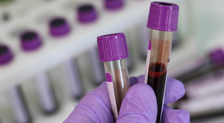 Τεστ αίματος ανιχνεύει 50 τύπους καρκίνου- Πώς μπορεί να επιταχύνει τη διάγνωση